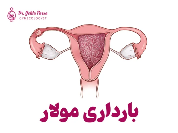 بارداری مولار