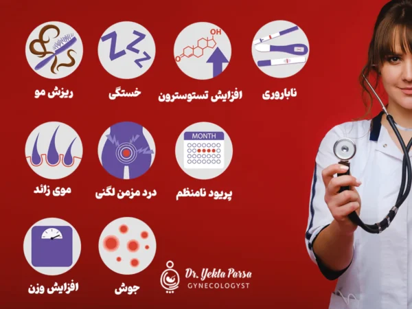 علائم و علل سندرم تخمدان پلی ‌کیستیک (PCOS)